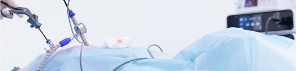 Laparoscopic Surgery