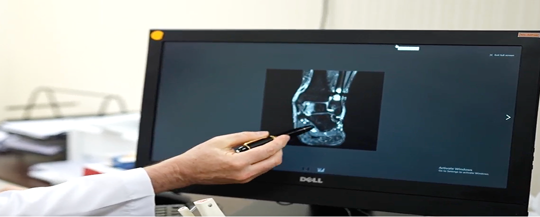 Orthopedic Oncology